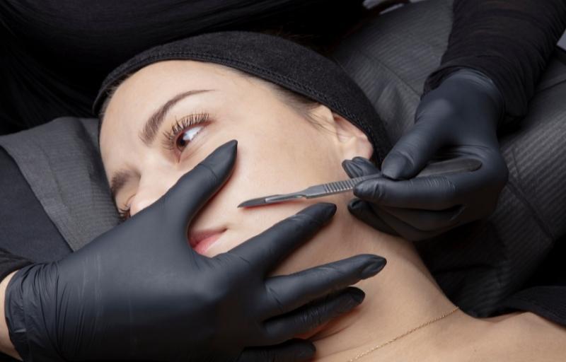 Dermaplaning face acne treatments Dermaplaning face acne treatments