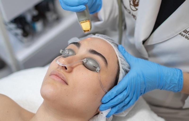 Laser Genesis acne treatments Laser Genesis acne treatments