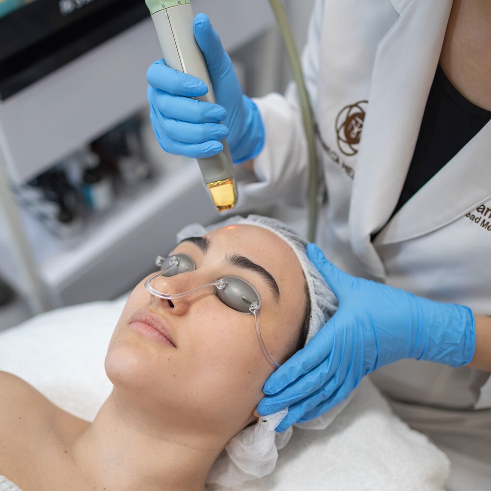 Close-up of a woman getting a laser treatment Close-up of a woman getting a laser treatment