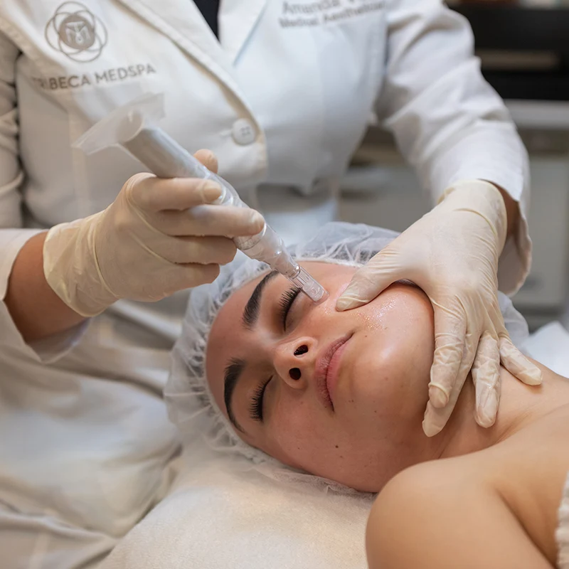 microneedling skincare treatment microneedling skincare treatment