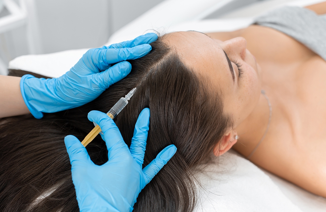 Pratitioner injecting the scalp of the client Pratitioner injecting the scalp of the client