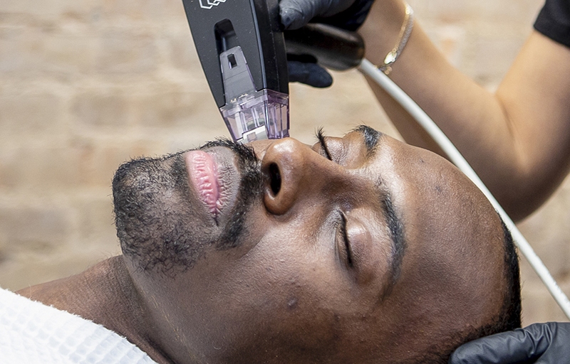 Morpheus 8 Treatment Morpheus 8 Treatment