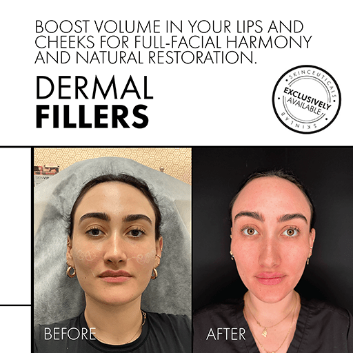 SkinLab Malika Lips and Cheeks