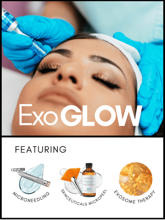 SL ExoGlow SL ExoGlow